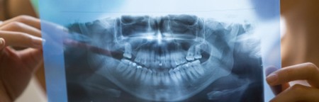 Dental x-ray for clinical assistant training