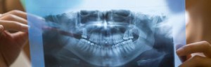 Image of Dental x-ray